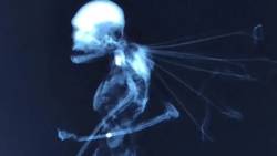 An X-ray image of a strange creature with wings has been published