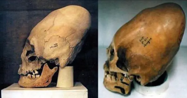 The alien skulls had an elongated shape